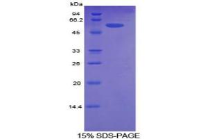 SDS-PAGE analysis of Human ALCAM Protein.