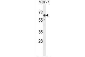 CO027 Antibody (C-term) western blot analysis in MCF-7 cell line lysates (35µg/lane). (C15orf27 Antikörper  (C-Term))
