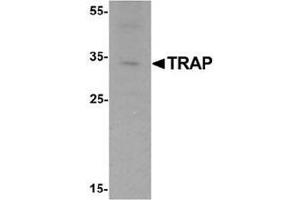 Western blot analysis of TRAP in mouse brain tissue lysate with TRAP Antibody  at 1 ug/mL. (ACP5 Antikörper  (C-Term))