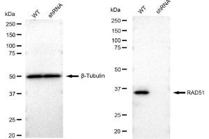 Western blotting analysis using RAD51 antibody (ABIN7798366). (Rekombinanter RAD51 Antikörper)