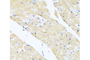 Immunohistochemistry of paraffin-embedded Mouse heart using EIF2S1 Polyclonal Antibody at dilution of 1:100 (40x lens). (EIF2S1 Antikörper)