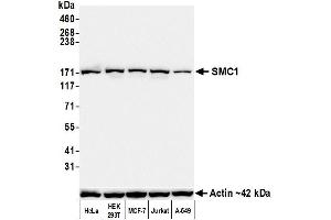 Western Blotting (WB) image for anti-Structural Maintenance of Chromosomes 1A (SMC1A) (C-Term) antibody (ABIN7455193) (Rekombinanter SMC1A Antikörper  (C-Term))