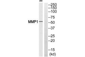 Western Blotting (WB) image for anti-Matrix Metallopeptidase 1 (Interstitial Collagenase) (MMP1) (Cleaved-Pro269) antibody (ABIN1853585) (MMP1 Antikörper  (Cleaved-Pro269))
