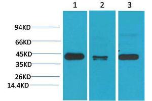 Western Blot (WB) analysis of 1) HeLa, 2)Mouse Brain Tissue, 3) Rat Brain Tissue with TBP/TATA Binding Protein Mouse Monoclonal Antibody diluted at 1:2000. (TBP Antikörper)