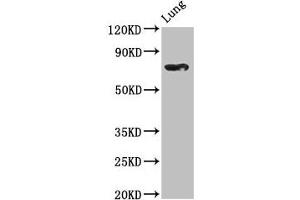 Western Blot Positive WB detected in: Rat lung tissue All lanes: TBX2 antibody at 2. (TBX2 Antikörper  (AA 299-573))