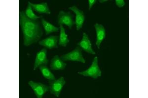 Immunofluorescence analysis of A549 cells using CDC5L antibody.