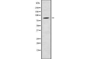 Western blot analysis of RGL1 using COLO205 whole cell lysates (RGL1 Antikörper  (Internal Region))