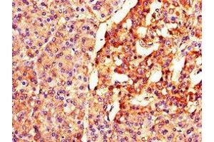 Immunohistochemistry of paraffin-embedded human pancreatic tissue using ABIN7152495 at dilution of 1:100 (BTRC Antikörper  (AA 397-448))