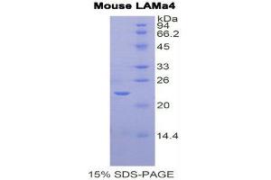 SDS-PAGE (SDS) image for Laminin, alpha 4 (LAMa4) (AA 457-630) protein (His tag) (ABIN2121518) (LAMa4 Protein (AA 457-630) (His tag))