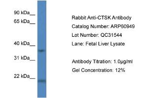 Western Blotting (WB) image for anti-Cathepsin K (CTSK) (Middle Region) antibody (ABIN2788629) (Cathepsin K Antikörper  (Middle Region))