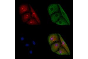 ABIN6258202 and ABIN6276045 staining  cells by IF/ICC. (LGR6 Antikörper  (Internal Region))