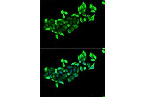 Immunofluorescence analysis of HeLa cells using FLOT1 antibody. (Flotillin 1 Antikörper)