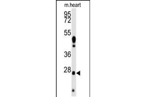 Western blot analysis of anti-WDYHV1 Antibody Pab in mouse heart tissue lysates (35ug/lane).
