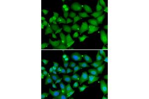 Immunofluorescence analysis of MCF-7 cells using RBBP7 antibody. (RBBP7 Antikörper)