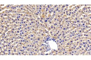 Detection of OSMR in Rat Liver Tissue using Polyclonal Antibody to Oncostatin M Receptor (OSMR) (Oncostatin M Receptor Antikörper  (AA 503-749))