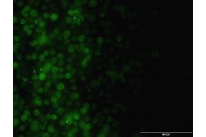 Immunofluorescence (IF) image for anti-Integrin-Linked Kinase (ILK) (AA 341-452) antibody (ABIN561483)