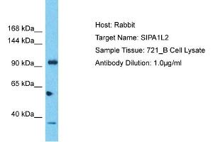Host: Rabbit Target Name: SIPA1L2 Sample Tissue: Human 721_B Whole Cell Antibody Dilution: 1ug/ml