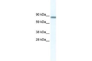WB Suggested Anti-GATAD2A Antibody Titration:  2. (GATAD2A Antikörper  (N-Term))