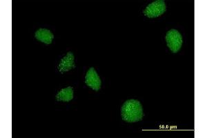 Immunofluorescence of purified MaxPab antibody to C21orf7 on HeLa cell. (MAP3K7CL Antikörper  (AA 1-242))
