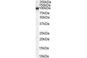 ABIN2562910 (0. (Purinergic Receptor P2Y, G-Protein Coupled, 13 (P2RY13) (Internal Region) Antikörper)