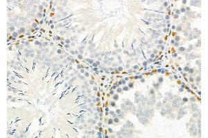 ABIN6262224 and ABIN6266867 at 1/100 staining Rat testis tissue by IHC-P. (HEXIM1 Antikörper  (C-Term))