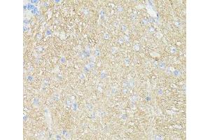 Immunohistochemistry of paraffin-embedded Mouse brain using THY1 Polyclonal Antibody at dilution of 1:100 (40x lens). (CD90 Antikörper)