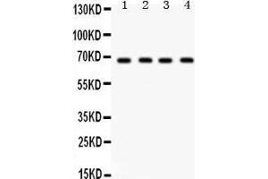 Western Blotting (WB) image for anti-G Protein-Coupled Receptor Kinase 5 (GRK5) (AA 393-429), (C-Term) antibody (ABIN3042434) (GRK5 Antikörper  (C-Term))