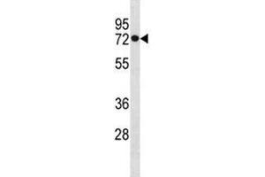 HSPA1L antibody western blot analysis in MDA-MB453 lysate. (HSPA1L Antikörper  (AA 576-603))