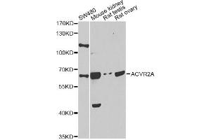 Western blot analysis of extracts of various cell lines, using ACVR2A antibody. (ACVR2A Antikörper)