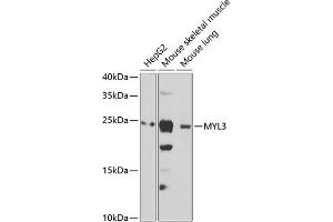 Western blot analysis of extracts of various cell lines, using MYL3 antibody (ABIN6133198, ABIN6144249, ABIN6144250 and ABIN6222363) at 1:1000 dilution. (MYL3/CMLC1 Antikörper  (AA 1-195))