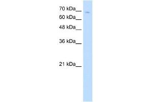 TCF25 antibody (20R-1266) used at 0. (TCF25 Antikörper  (N-Term))