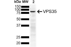 Western Blot analysis of Human SH-SY5Y showing detection of VPS35 protein using Mouse Anti-VPS35 Monoclonal Antibody, Clone 11H10 (ABIN6933004). (VPS35 Antikörper)