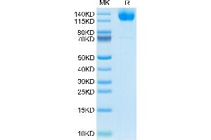 Human MERTK on Tris-Bis PAGE under reduced condition. (MERTK Protein (AA 21-505) (mFc Tag))