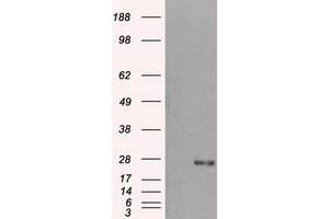 Western Blotting (WB) image for anti-Dicarbonyl/L-Xylulose Reductase (DCXR) antibody (ABIN1497784) (DCXR Antikörper)