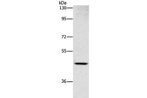 Western Blot analysis of Human placenta tissue using CD327 Polyclonal Antibody at dilution of 1:1000 (SIGLEC6 Antikörper)