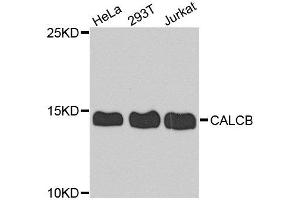 Western blot analysis of extract of various cells, using CALCB antibody. (CALCB Antikörper)