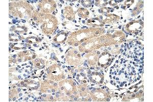 EXOSC7 antibody was used for immunohistochemistry at a concentration of 4-8 ug/ml to stain Epithelial cells of renal tubule (arrows) in Human Kidney. (EXOSC7 Antikörper  (N-Term))
