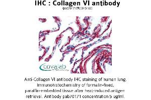 Image no. 1 for anti-Collagen, Type VI (COL6) antibody (ABIN1733229) (COL6 Antikörper)