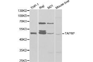 Western blot analysis of extracts of various cell lines, using TAPBP antibody (ABIN6293644) at 1:1000 dilution. (TAPBP Antikörper)