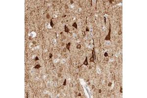 Immunohistochemical staining (Formalin-fixed paraffin-embedded sections) of human cerebral cortex with TNK1 polyclonal antibody  shows strong cytoplasmic positivity in neuronal cells at 1:20-1:50 dilution. (TNK1 Antikörper)
