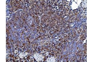 IHC analysis of CD226 using anti-CD226 antibody (ABIN7601264). (CD226 Antikörper  (AA 31-333))