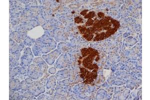 Formalin Fixed, Paraffin Embedded Human pancreas stained with Mouse anti Pig Insulin Antibody Cat. (Insulin Antikörper)