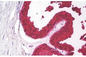 Image no. 2 for anti-Prostate Specific Antigen (PSA) antibody (ABIN1502668)