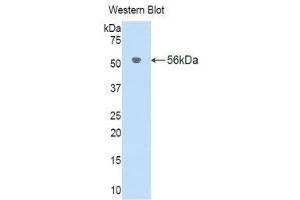 Western Blotting (WB) image for anti-Interleukin 18 Binding Protein (IL18BP) (AA 29-193) antibody (ABIN1176682)