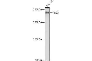 Western blot analysis of extracts of HepG2 cells, using PEG3 antibody (ABIN6128527, ABIN6145434, ABIN6145435 and ABIN6216398) at 1:1000 dilution. (PEG3 Antikörper  (AA 1-300))