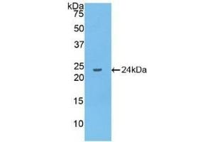 Detection of Recombinant IL10, Human using Polyclonal Antibody to Interleukin 10 (IL10) (IL-10 Antikörper  (AA 1-178))