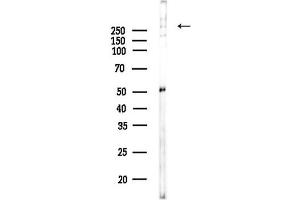 Western blot analysis of lysates from 3-L1 P6(LPS,4h treatment), using Thyroglobulin Antibody at 1/1000 dilution.