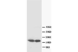 Western Blotting (WB) image for anti-S100 Calcium Binding Protein B (S100B) antibody (ABIN1108929) (S100B Antikörper)