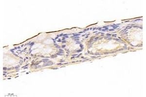 Immunohistochemistry analysis of paraffin-embedded mouse colon using,NHE-3 (ABIN7075685) at dilution of 1: 1200 (SLC9A3 Antikörper)
