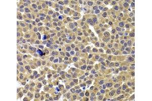 Immunohistochemistry of paraffin-embedded Mouse lung cancer using ARID3A Polyclonal Antibody at dilution of 1:100 (40x lens). (ARID3A Antikörper)